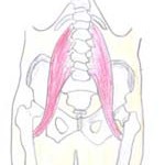 Image of psoas muscle